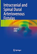 Télécharger le livre :  Intracranial and Spinal Dural Arteriovenous Fistulas