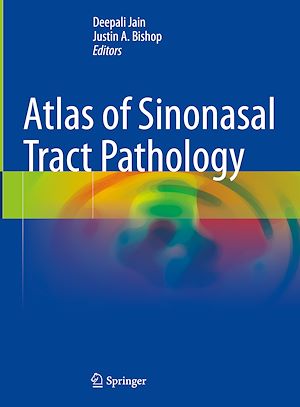 Téléchargez le livre :  Atlas of Sinonasal Tract Pathology
