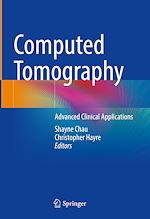 Télécharger le livre :  Computed Tomography