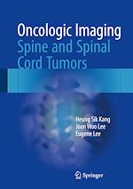 Télécharger le livre :  Oncologic Imaging: Spine and Spinal Cord Tumors