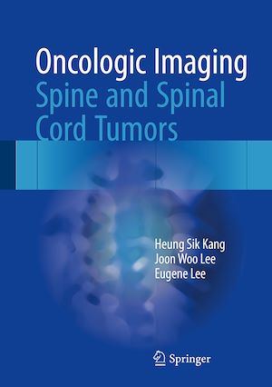Téléchargez le livre :  Oncologic Imaging: Spine and Spinal Cord Tumors