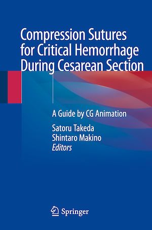 Téléchargez le livre :  Compression Sutures for Critical Hemorrhage During Cesarean Section