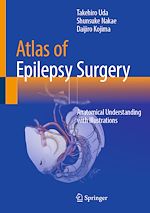 Download this eBook Atlas of Epilepsy Surgery