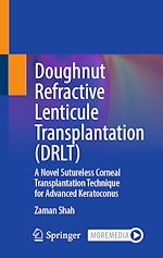 Download this eBook Doughnut Refractive Lenticule Transplantation (DRLT)