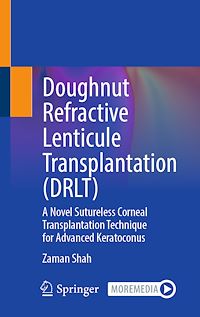 Download this ebook Doughnut Refractive Lenticule Transplantation (DRLT)