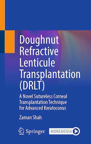 Download the eBook: Doughnut Refractive Lenticule Transplantation (DRLT)