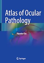 Télécharger le livre :  Atlas of Ocular Pathology