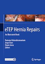 Télécharger le livre :  eTEP Hernia Repairs