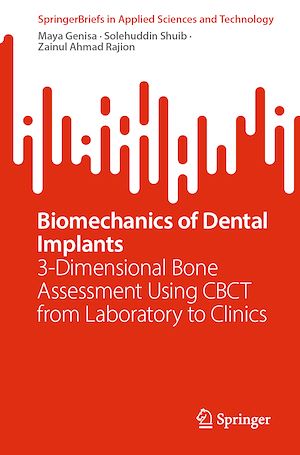 Téléchargez le livre :  Biomechanics of Dental Implants