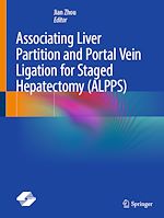 Télécharger le livre :  Associating Liver Partition and Portal Vein Ligation for Staged Hepatectomy (ALPPS)
