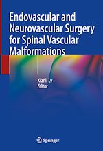 Télécharger le livre :  Endovascular and Neurovascular Surgery for Spinal Vascular Malformations