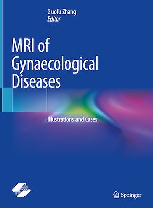 Télécharger le livre :  MRI of Gynaecological Diseases