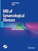 Télécharger le livre :  MRI of Gynaecological Diseases
