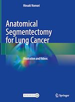 Télécharger le livre :  Anatomical Segmentectomy for Lung Cancer