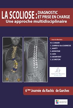 Télécharger le livre :  La scoliose : diagnostic et prise en charge