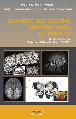 Télécharger le livre :  Imagerie des lésions dégénératives du cerveau