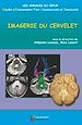 Télécharger le livre :  Imagerie du cervelet