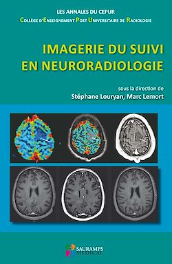 Télécharger le livre :  Imagerie du suivi en neuroradiologie