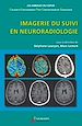 Télécharger le livre :  Imagerie du suivi en neuroradiologie