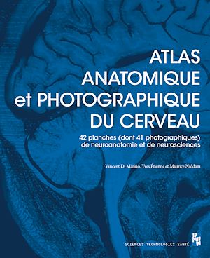 Download the eBook: Atlas anatomique et photographique du cerveau