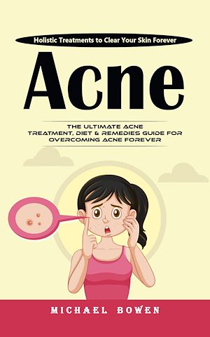 Téléchargez le livre :  Acne: Holistic Treatments to Clear Your Skin Forever (The Ultimate Acne Treatment, Diet & Remedies Guide for Overcoming Acne Forever)
