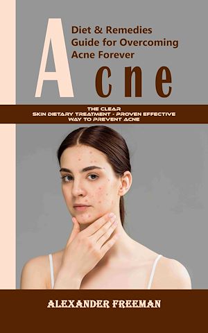 Téléchargez le livre :  Acne: Diet & Remedies Guide for Overcoming Acne Forever (The Clear Skin Dietary Treatment - Proven Effective Way to Prevent Acne)