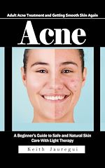 Télécharger le livre :  Acne: Adult Acne Treatment and Getting Smooth Skin Again (A Beginner's Guide to Safe and Natural Skin Care With Light Therapy)