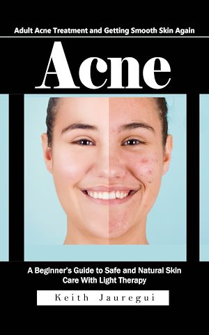 Téléchargez le livre :  Acne: Adult Acne Treatment and Getting Smooth Skin Again (A Beginner's Guide to Safe and Natural Skin Care With Light Therapy)