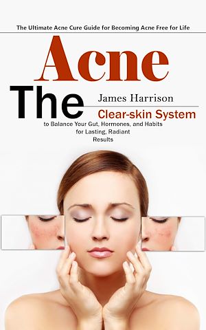 Download the eBook: Acne: The Ultimate Acne Cure Guide for Becoming Acne Free for Life (The Clear-skin System to Balance Your Gut, Hormones, and Habits for Lasting, Radiant Results)