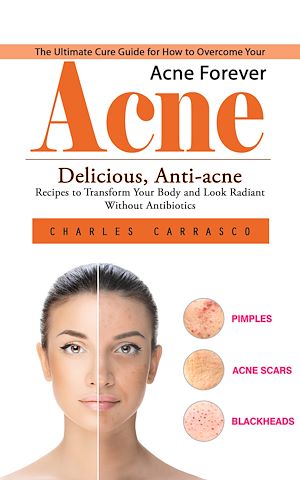 Téléchargez le livre :  Acne: The Ultimate Cure Guide for How to Overcome Your Acne Forever (Delicious, Anti-acne Recipes to Transform Your Body and Look Radiant without Antibiotics)