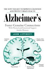 Télécharger le livre :  Alzheimer's: The New Toolkit to Improve Cognition and Protect Brain Health (Foster Genuine Connections With Physical and Emotional Support Amidst Memory)