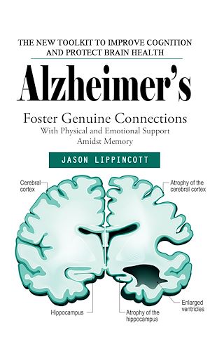 Téléchargez le livre :  Alzheimer's: The New Toolkit to Improve Cognition and Protect Brain Health (Foster Genuine Connections With Physical and Emotional Support Amidst Memory)