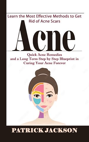 Téléchargez le livre :  Acne: Learn the Most Effective Methods to Get Rid of Acne Scars (Quick Acne Remedies and a Long Term Step by Step Blueprint in Curing Your Acne Forever)