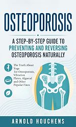 Download this eBook Osteoporosis: A Step-by-step Guide to Preventing and Reversing Osteoporosis Naturally
