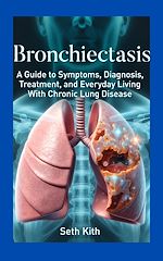 Download this eBook Bronchiectasis